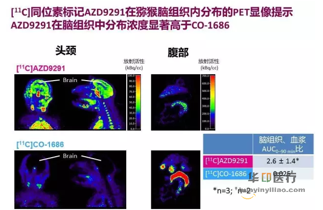 AZD9291在NSCLC脑转移研究