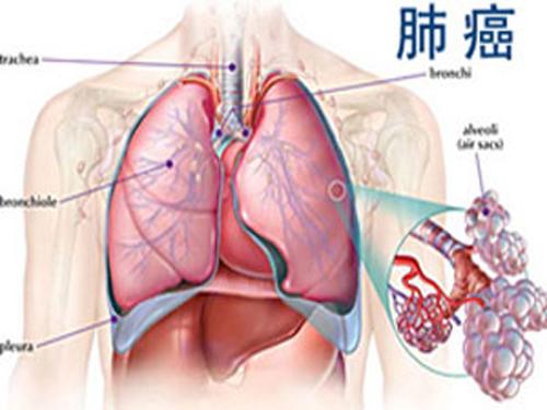 凯美纳治疗肺癌的疗效怎么样?