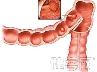 经常吃肉对容易引发肠癌