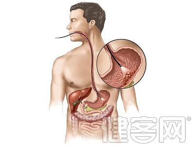 肿瘤患者饮食知多少？