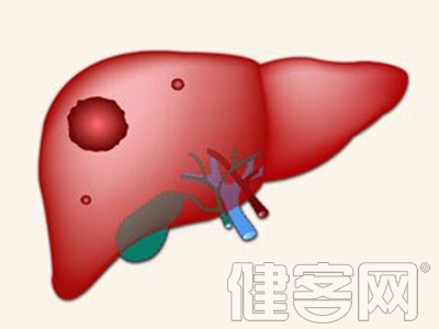 肝癌与肝炎有直接联系